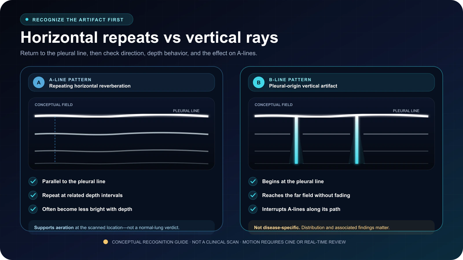 Conceptual comparison of repeating horizontal A-lines with vertical B-lines that begin at the pleural line, reach the far field without fading, and interrupt A-lines