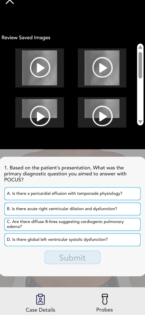 POCUS Simulator case screen asking the learner to interpret ultrasound clips
