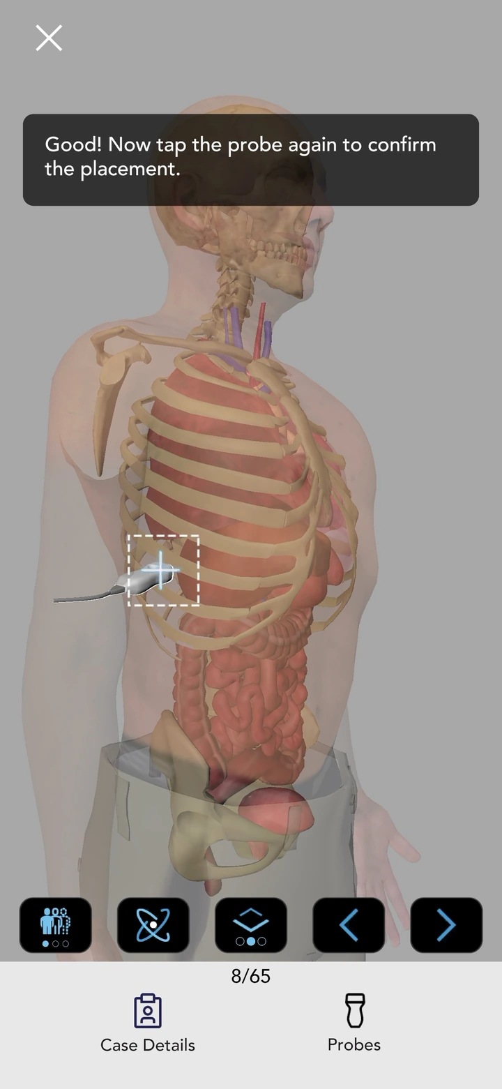 Recorded eFAST Skills Lab screen showing probe-position confirmation at the right upper quadrant.